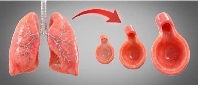 PulmoClean BioCare